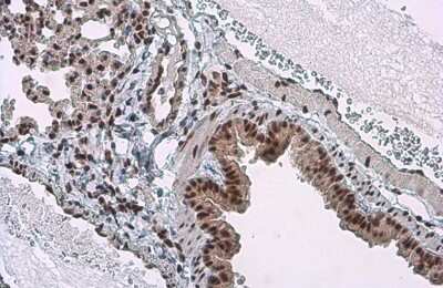 Immunohistochemistry-Paraffin: c-jun [p Ser73] Antibody [NBP3-13304]